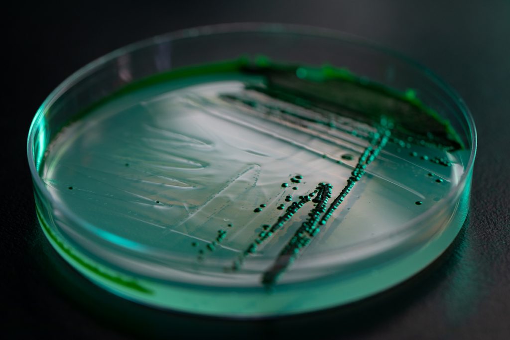 Algae in a petri dish